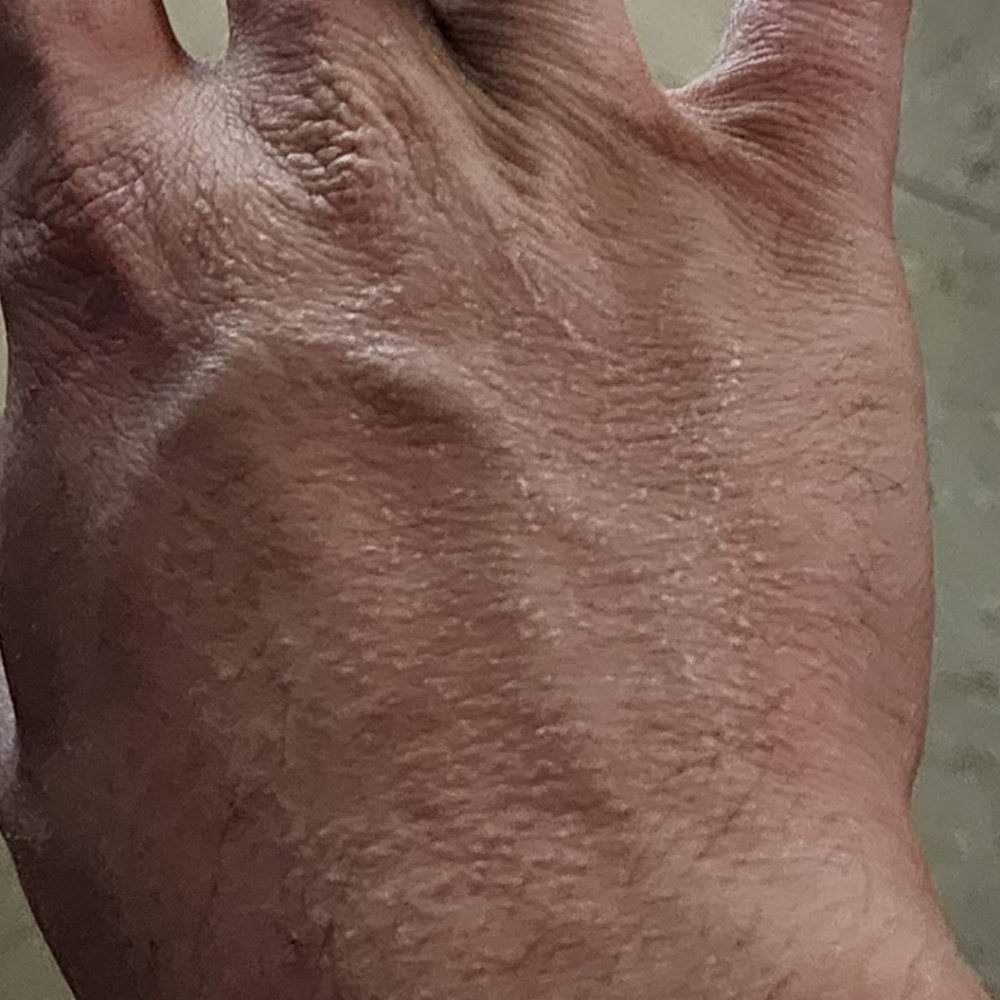 Exfoliator - Picture 6 of 8